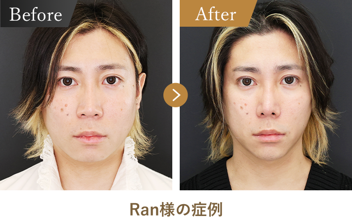 Ran様の症例