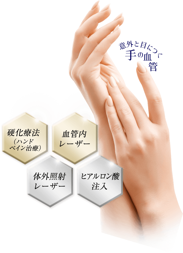 硬化療法（ハンドベイン治療）｜血管内レーザー｜対外照射レーザー｜ヒアルロン酸注入