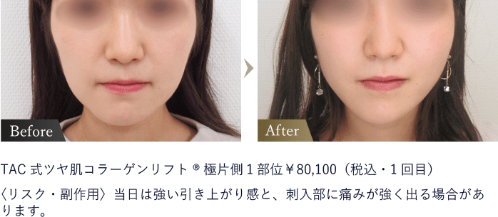 ビフォーアフター画像