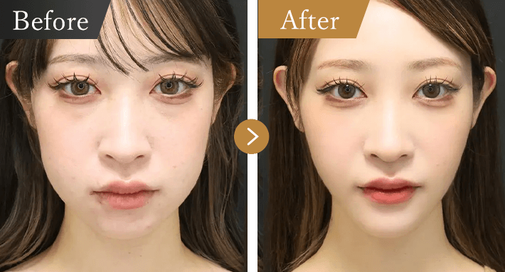 症例写真