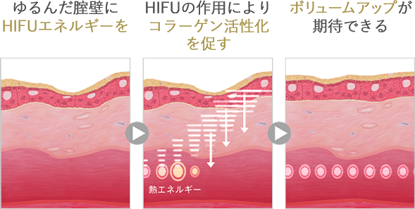 ヴィーナスハイフ
