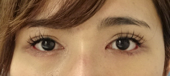 正面