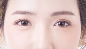 コスメリング