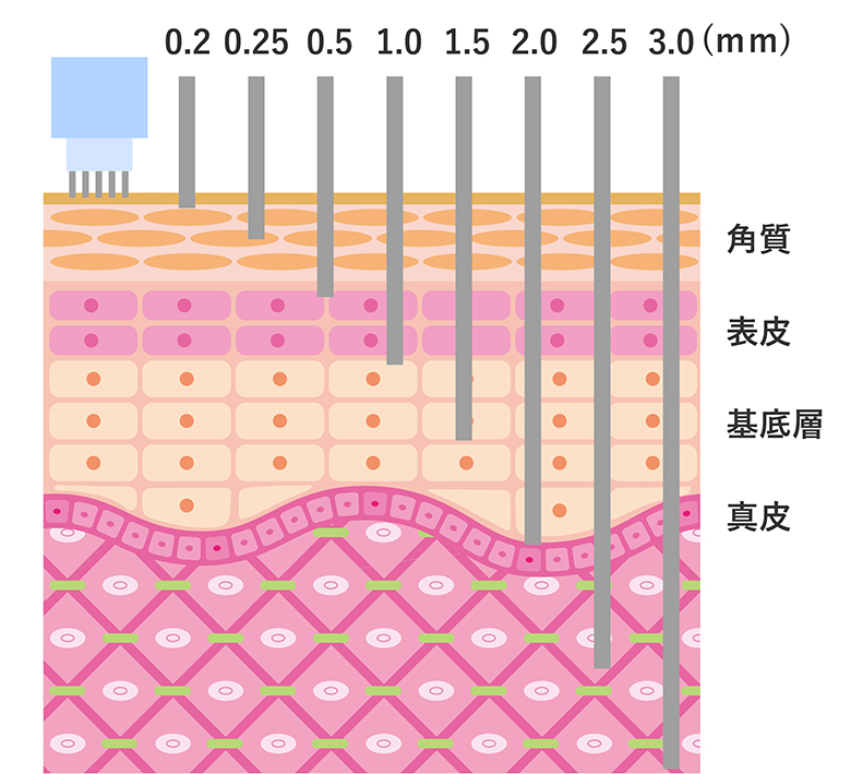 肌に入る針の深さ