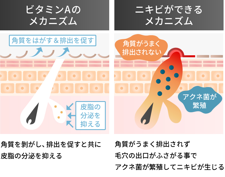 老人性色素斑・肝斑