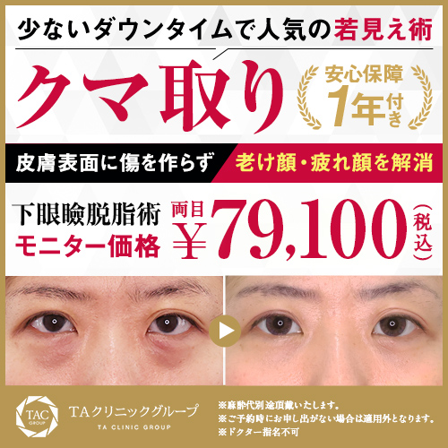 下眼瞼脱脂（目の下のクマ・ふくらみとり）モニター募集