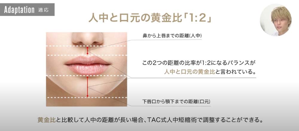 人中と口元の黄金比「１：２」｜黄金比と比較して人中の距離が長い場合、TAC式人中短縮術で調整することができる。