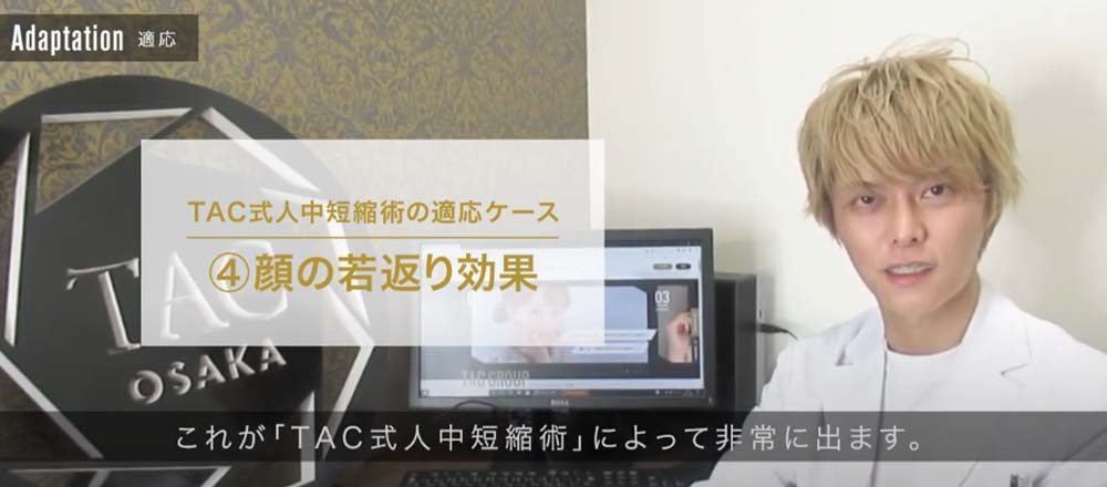 TAC式人中短縮術の適応ケース「顔の若返り効果」｜これが「TAC式人中短縮術」によって非常に出ます。