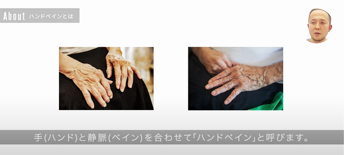 ハンドベインとは