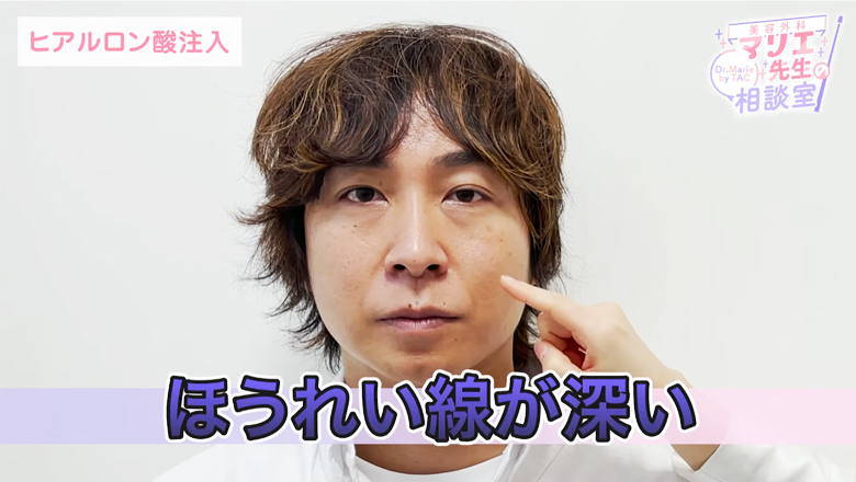 ほうれい線が深い