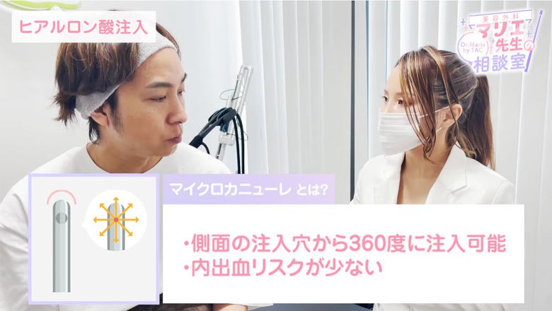 マイクロカニューレとは？側面の注入穴から360度に注入可能｜内出血リスクが少ない