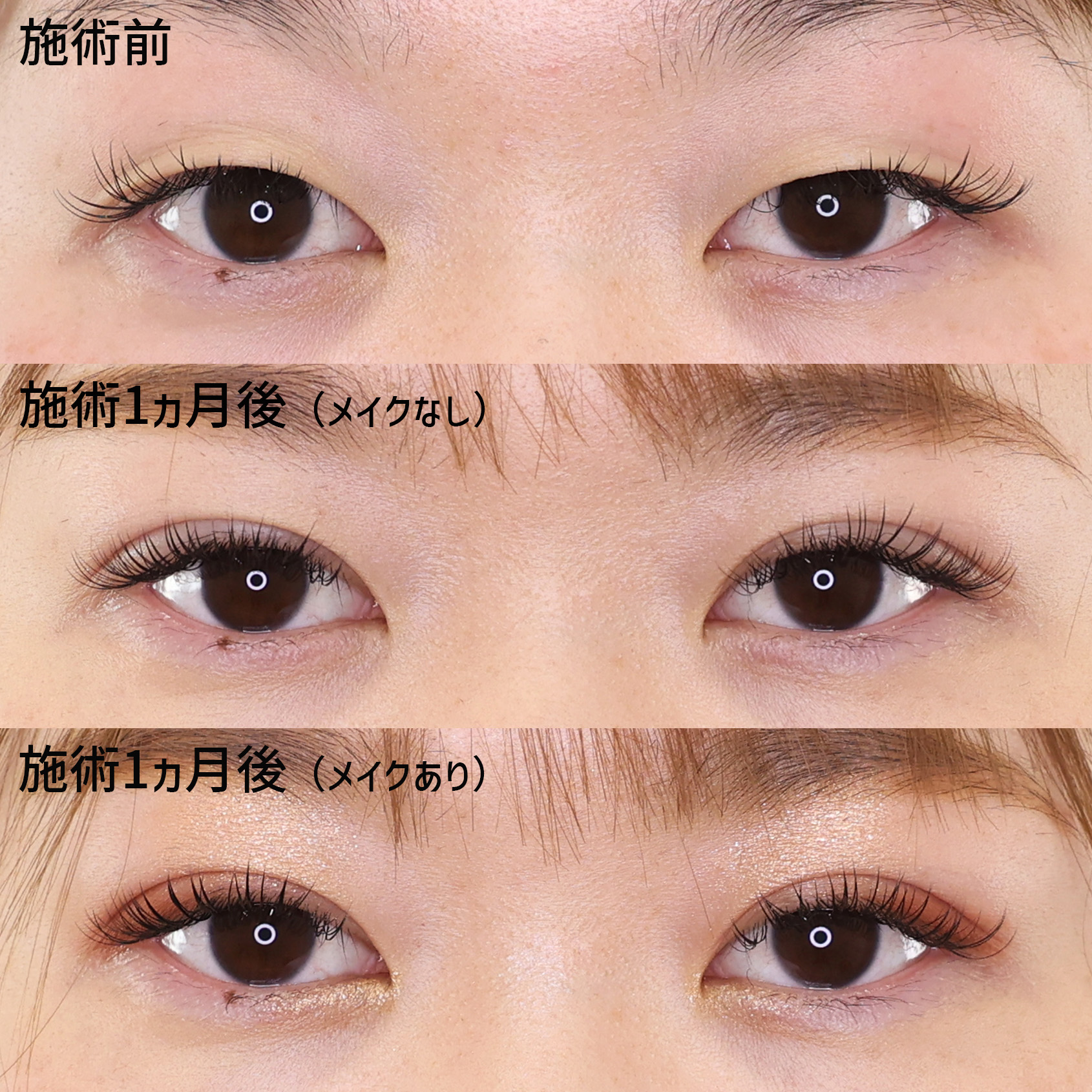 の症例写真 施術前後 
