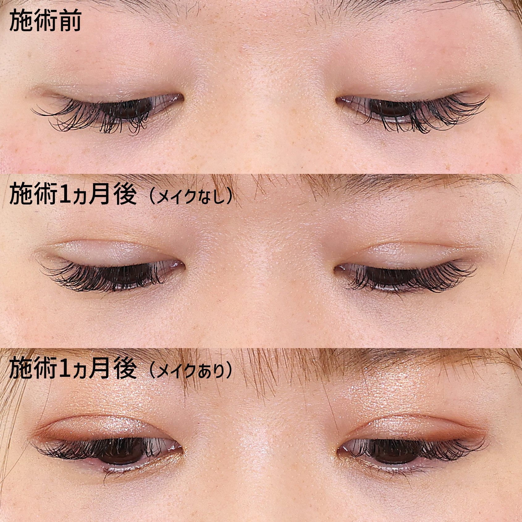 の症例写真 施術前後 