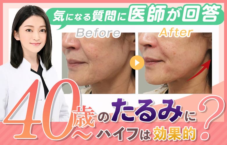 40～50歳代のお肌のたるみにハイフは効果あるのか