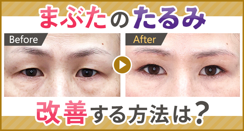 まぶたのたるみ、改善する方法は？