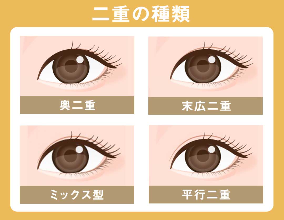 二重の種類