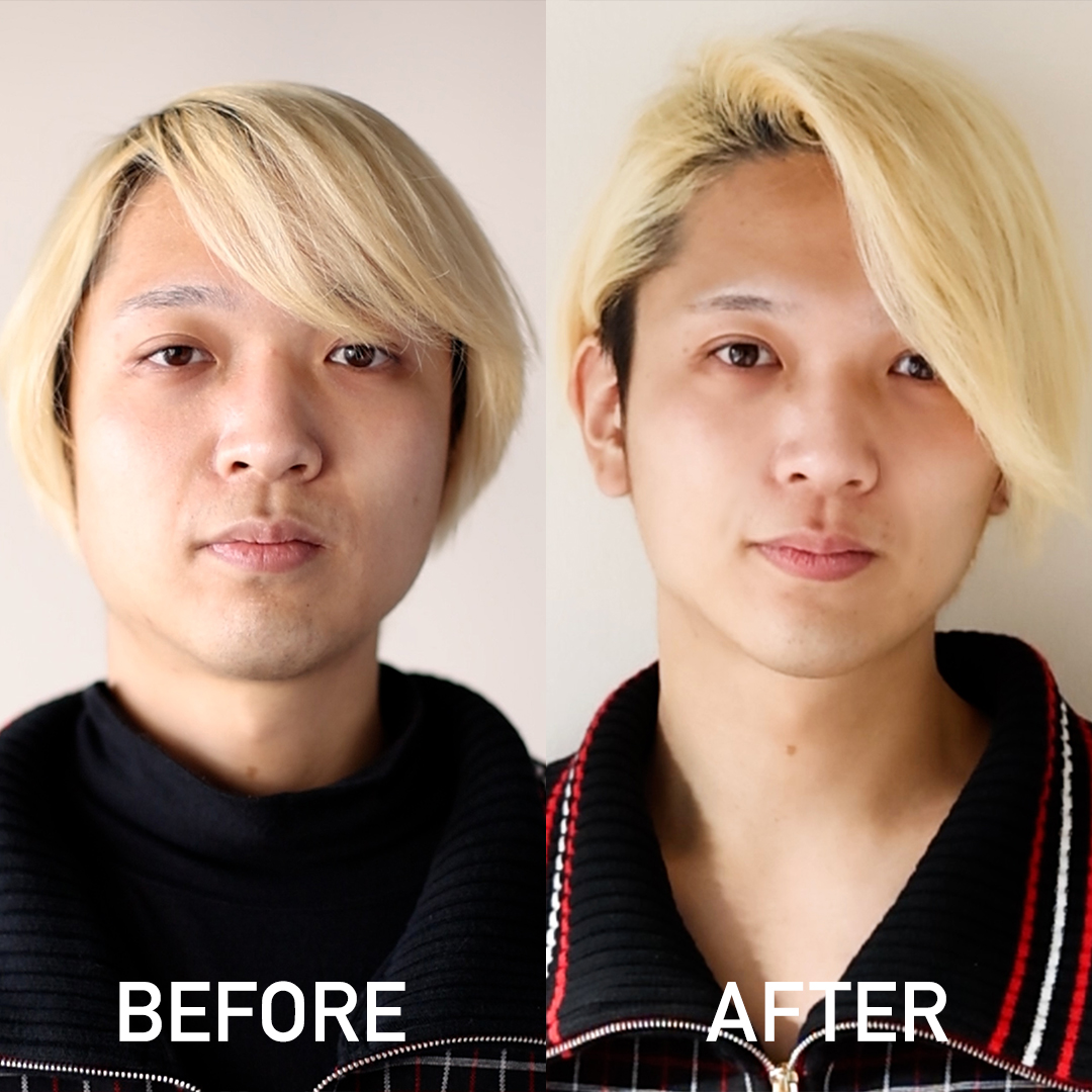自分らしさを失わない整形を【男の小顔施術】