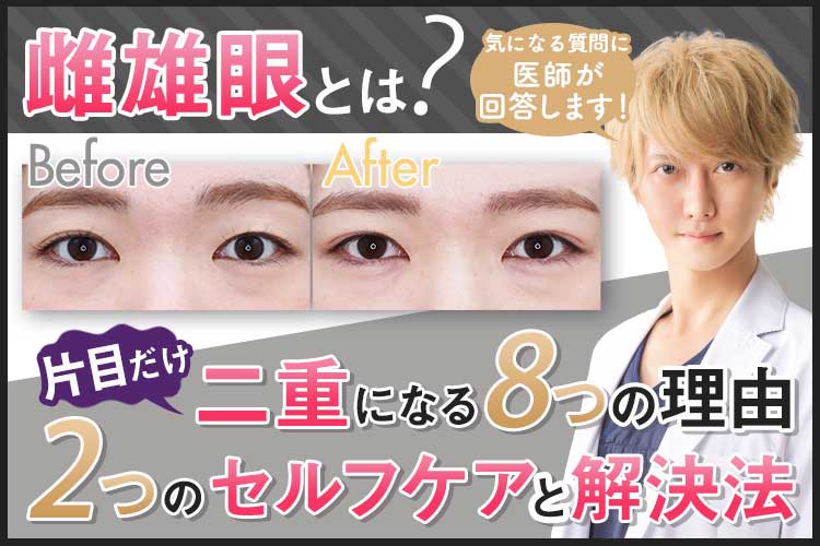 【雌雄眼】芸能人にも多い片目だけ二重！8つの原因と治し方