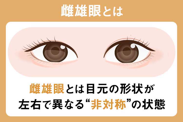 雌雄眼とは？