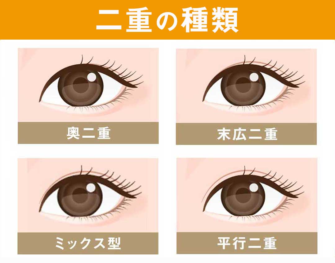 二重の種類 奥二重、末広二重、平行二重