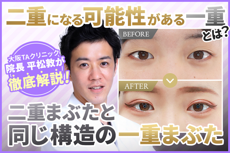 【二重にする方法8選】二重になる可能性がある一重とならない人の違い