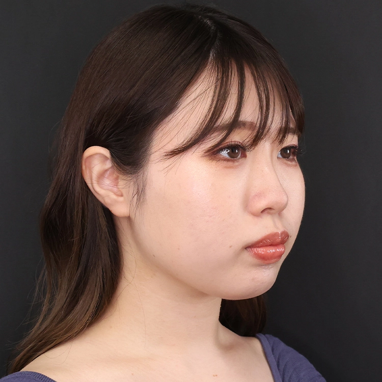 施術前の様子