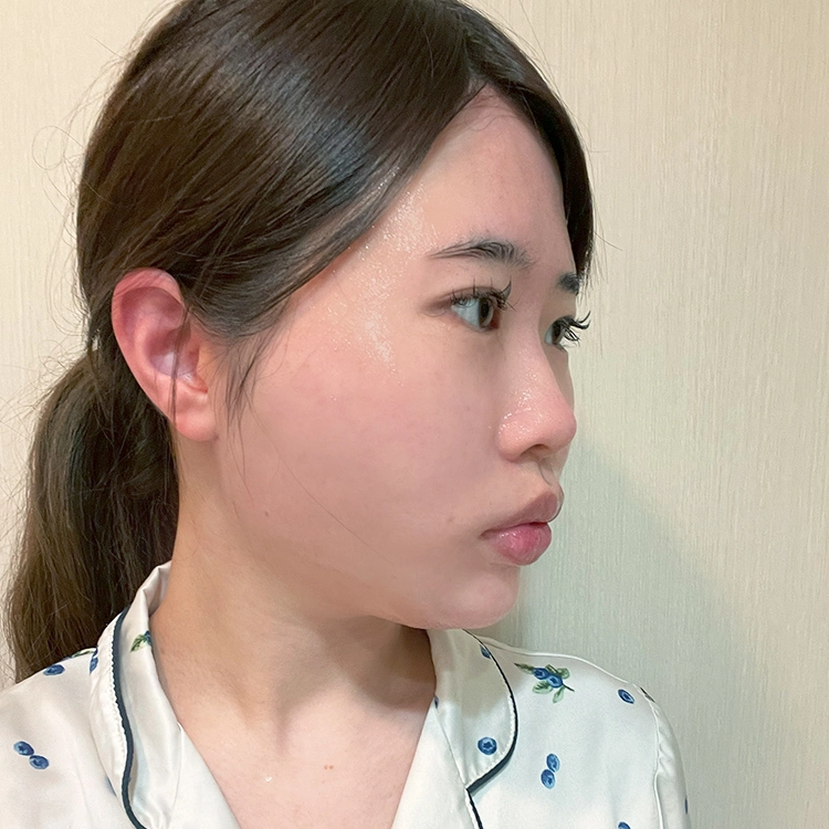 施術3日後