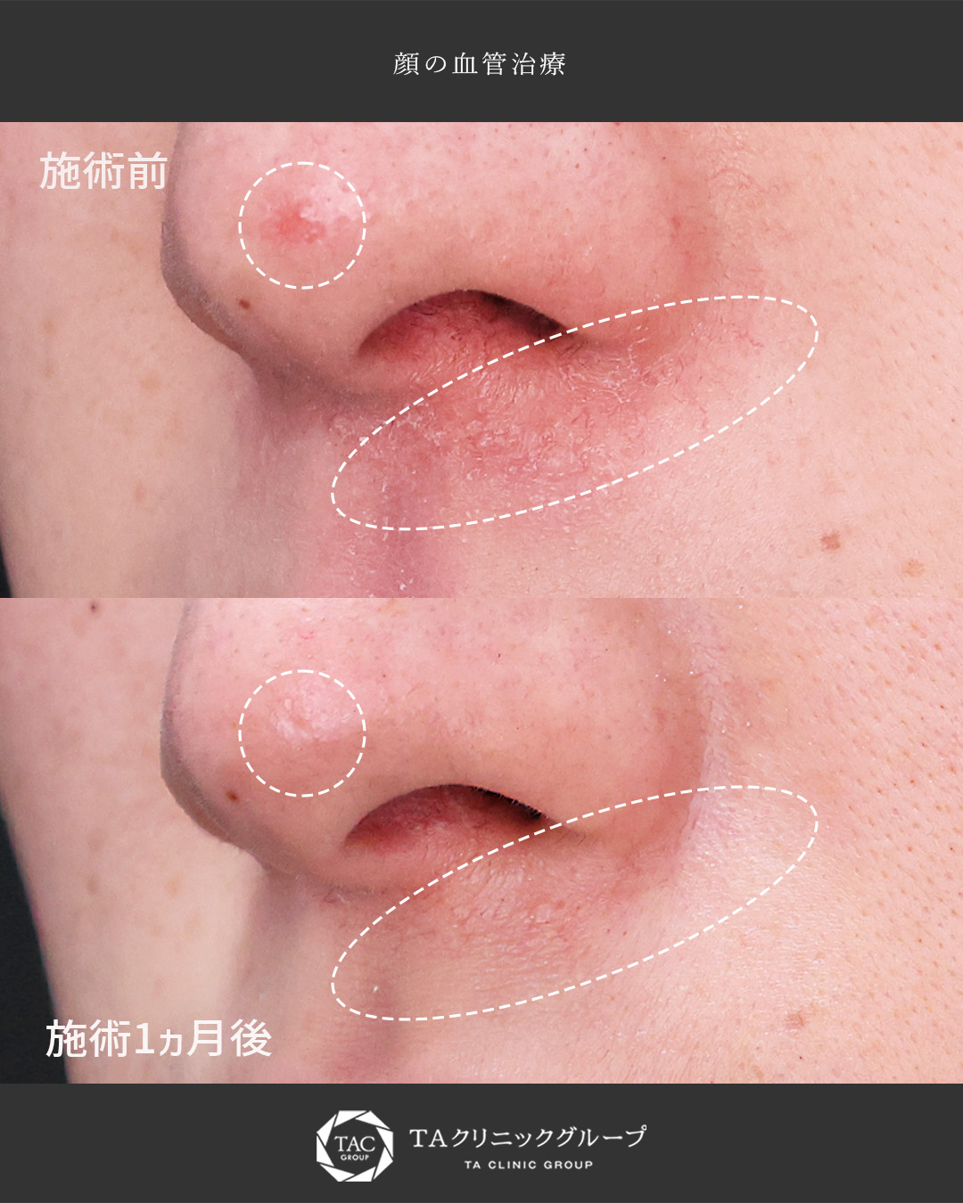 美容外科：その他の症例写真 施術前後 