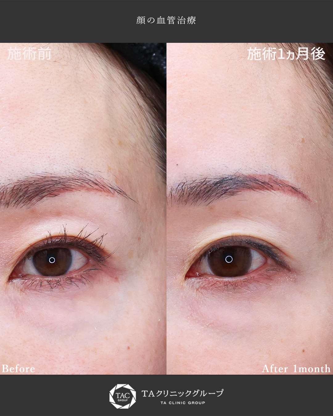美容外科：その他の症例写真 施術前後 